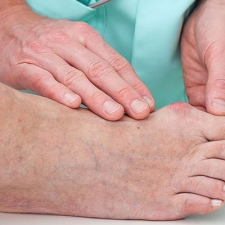 Reumatyzm stóp - objawy, leczenie i przebieg choroby